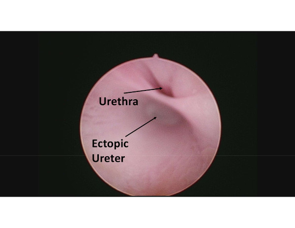 Interventional Radiology Interventional Radiology